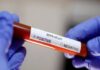 लगभग 1 अरब भारतीय हो सकते हैं कोरोना से संक्रमित Corona virus